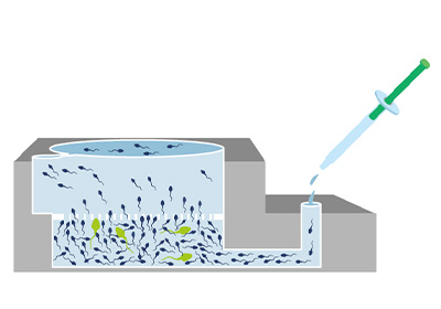 膜構造を用いた生理学的精子選択術