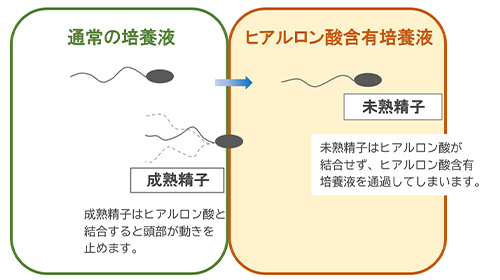 ヒアルロン酸を用いた生理学的精子選択術