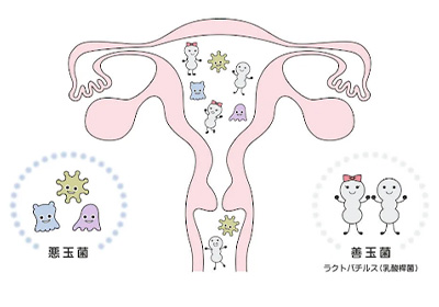 子宮内細菌叢検査2