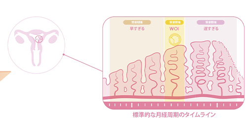 子宮内膜受容期検査